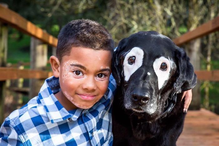 Мальчик с редким заболеванием кожи ненавидел свой внешний вид, пока не встретил такую же собаку