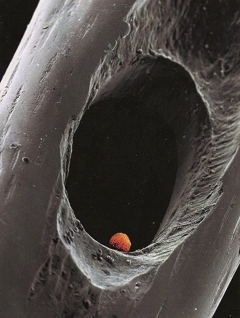 Эмбрион в игольном ушке
