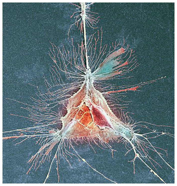 Эта клетка олигодендроцит образует миелиновые оболочки вокруг ваших нервных волокон. Их разрушение ведет к инвалидности и смерти