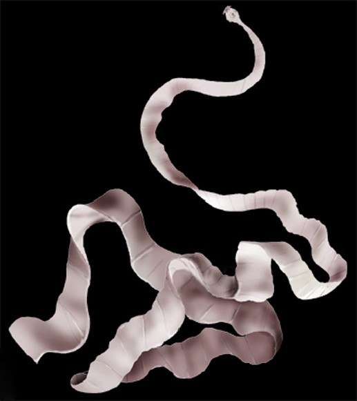 При недостатке еды ленточный червь может съесть до 95 % веса своего тела - и ничего!